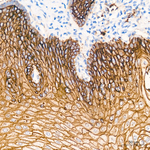 TROP2 Antibody in Immunohistochemistry (Paraffin) (IHC (P))