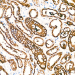 TROP2 Antibody in Immunohistochemistry (Paraffin) (IHC (P))