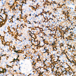 TROP2 Antibody in Immunohistochemistry (Paraffin) (IHC (P))