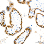 TROP2 Antibody in Immunohistochemistry (Paraffin) (IHC (P))