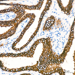 TROP2 Antibody in Immunohistochemistry (Paraffin) (IHC (P))