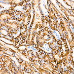 TROP2 Antibody in Immunohistochemistry (Paraffin) (IHC (P))