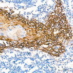 TROP2 Antibody in Immunohistochemistry (Paraffin) (IHC (P))
