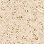 RAB11A/RAB11B Antibody in Immunohistochemistry (Paraffin) (IHC (P))
