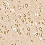 RAB11A/RAB11B Antibody in Immunohistochemistry (Paraffin) (IHC (P))