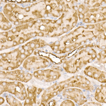 RAB11A/RAB11B Antibody in Immunohistochemistry (Paraffin) (IHC (P))