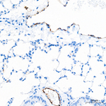VWF Antibody in Immunohistochemistry (Paraffin) (IHC (P))