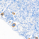 VWF Recombinant Rabbit Monoclonal Antibody (3T1C4)