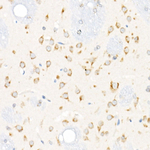 IGF2R Antibody in Immunohistochemistry (Paraffin) (IHC (P))