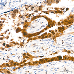 HSP70 Antibody in Immunohistochemistry (Paraffin) (IHC (P))