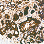 HSP70 Antibody in Immunohistochemistry (Paraffin) (IHC (P))