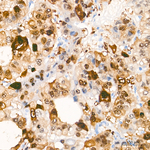 HSP70 Antibody in Immunohistochemistry (Paraffin) (IHC (P))