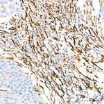 TGM2 Antibody in Immunohistochemistry (Paraffin) (IHC (P))