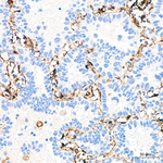 TGM2 Antibody in Immunohistochemistry (Paraffin) (IHC (P))