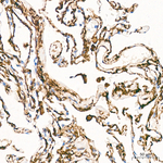TGM2 Antibody in Immunohistochemistry (Paraffin) (IHC (P))