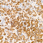 DAP5 Antibody in Immunohistochemistry (Paraffin) (IHC (P))