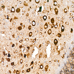 DAP5 Antibody in Immunohistochemistry (Paraffin) (IHC (P))