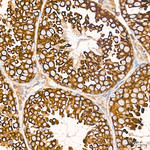 DAP5 Antibody in Immunohistochemistry (Paraffin) (IHC (P))