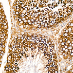 DAP5 Antibody in Immunohistochemistry (Paraffin) (IHC (P))