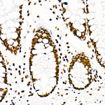 H3R8me2s Antibody in Immunohistochemistry (Paraffin) (IHC (P))
