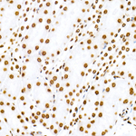 H3R8me2s Antibody in Immunohistochemistry (Paraffin) (IHC (P))