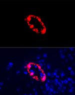 TAGLN Antibody in Immunohistochemistry (Paraffin) (IHC (P))