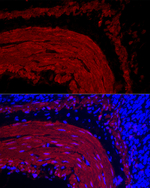 TAGLN Antibody in Immunohistochemistry (Paraffin) (IHC (P))