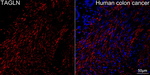 TAGLN Antibody in Immunohistochemistry (Paraffin) (IHC (P))