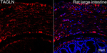 TAGLN Recombinant Rabbit Monoclonal Antibody (9C5T7)