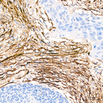 TAGLN Antibody in Immunohistochemistry (Paraffin) (IHC (P))