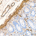 TAGLN Antibody in Immunohistochemistry (Paraffin) (IHC (P))