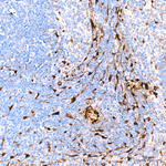 TAGLN Antibody in Immunohistochemistry (Paraffin) (IHC (P))