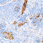 TAGLN Antibody in Immunohistochemistry (Paraffin) (IHC (P))