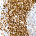 CD79b Antibody in Immunohistochemistry (Paraffin) (IHC (P))