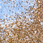 CD79b Recombinant Rabbit Monoclonal Antibody (5X3V4)