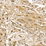 PHD3 Antibody in Immunohistochemistry (Paraffin) (IHC (P))