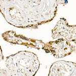PHD3 Antibody in Immunohistochemistry (Paraffin) (IHC (P))