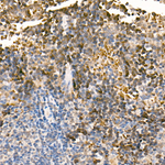 PHD3 Antibody in Immunohistochemistry (Paraffin) (IHC (P))