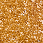 TrkB Antibody in Immunohistochemistry (Paraffin) (IHC (P))