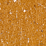 TrkB Antibody in Immunohistochemistry (Paraffin) (IHC (P))