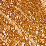 TrkB Recombinant Rabbit Monoclonal Antibody (4S7R7)