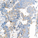 COX7A1 Antibody in Immunohistochemistry (Paraffin) (IHC (P))