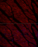 Cardiac Troponin I Antibody in Immunohistochemistry (Paraffin) (IHC (P))