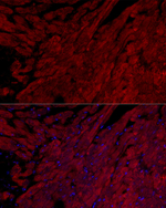 Cardiac Troponin I Recombinant Rabbit Monoclonal Antibody (8Y3Q2)