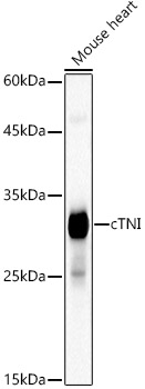 Cardiac Troponin I Antibody in Western Blot (WB)