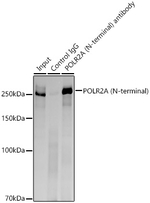 POLR2A Antibody in Immunoprecipitation (IP)
