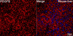 PDGF-B Antibody in Immunohistochemistry (Paraffin) (IHC (P))
