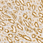 PDGF-B Antibody in Immunohistochemistry (Paraffin) (IHC (P))
