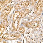PDGF-B Antibody in Immunohistochemistry (Paraffin) (IHC (P))