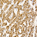 HAO1 Recombinant Rabbit Monoclonal Antibody (1C5E8)